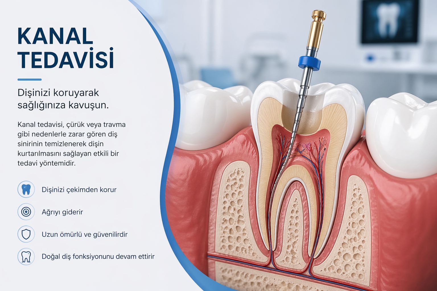 Kanal Tedavisi (Endodonti)